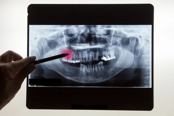 Filme de raio-X dental panorâmico para dentista — Fotografia de Stock
