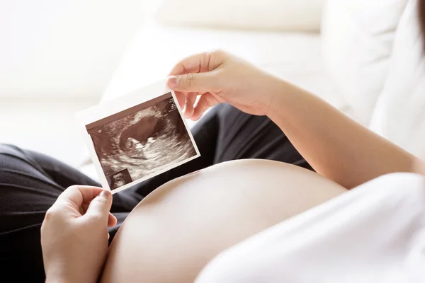 Mulher grávida com imagem ultra-sonográfica — Fotografia de Stock