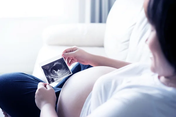 Mulher grávida com imagem ultra-sonográfica — Fotografia de Stock