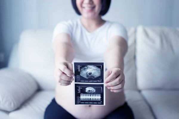 Έγκυος γυναίκα με υπερηχογραφική εικόνα σάρωσης — Φωτογραφία Αρχείου