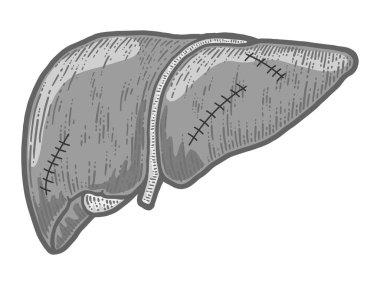 Human liver with stitches isolated on white background. Sketch scratch board imitation color.