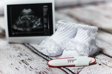Bebek Patik ve pozitif gebelik testi tutan genç kadın