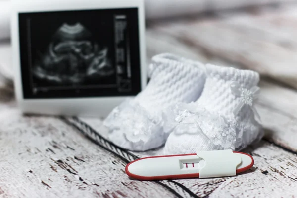 Young woman holding baby shoes and positive pregnancy test — Stock Photo, Image