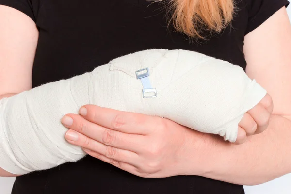 Young female with broken hand in cast — Stock Photo, Image