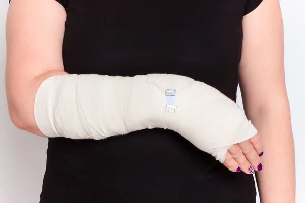 Young female with broken hand in cast — Stock Photo, Image