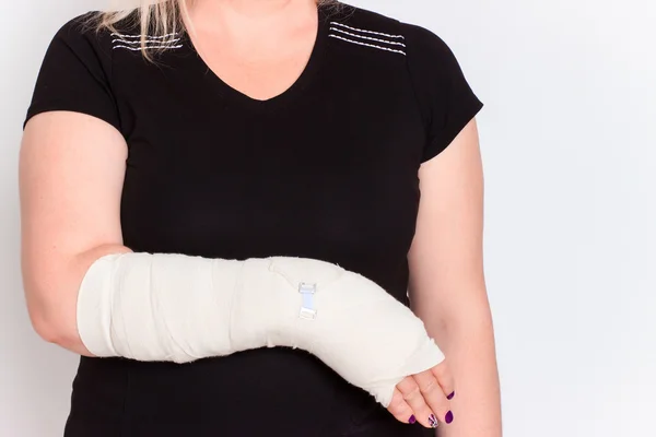 Young female with broken hand in cast — Stock Photo, Image