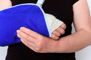 döküm kırık el ile genç erkek