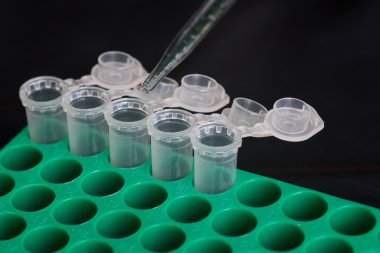 Mikro santrifüj tüpü