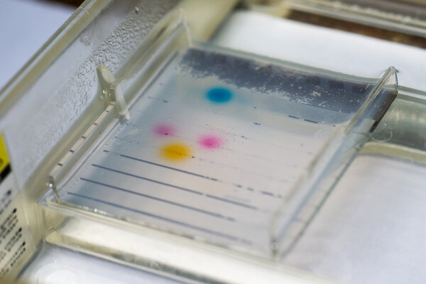 Agarose gel electrophoresis closeup