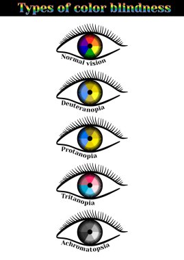 Types of color blindness. clipart