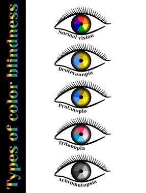Types of color blindness. clipart