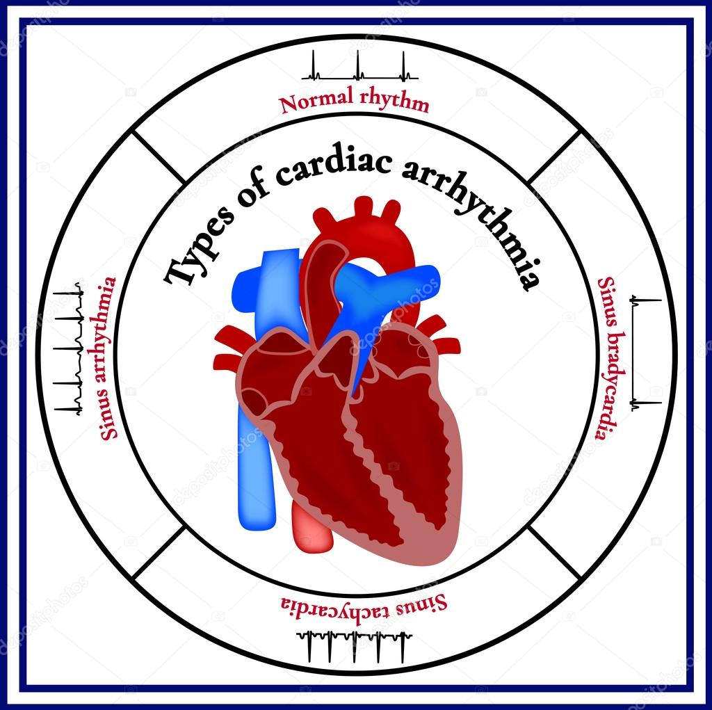 Heart structure. Types of cardiac arrhythmia.