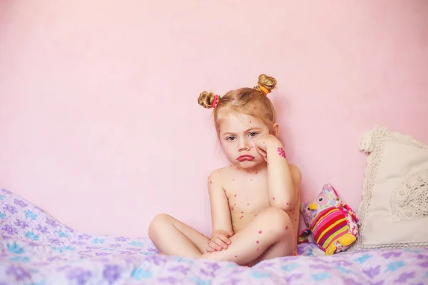 Bambino seduto sul letto con eruzione cutanea di varicella di pollo, foto naturale Fotografia Stock
