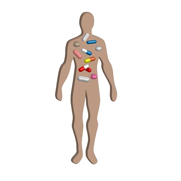 Tratamiento de la sobremedicación del paciente en 3D — Vector de stock