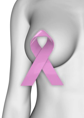 Göğüs Kanseri - 3B Konsepti