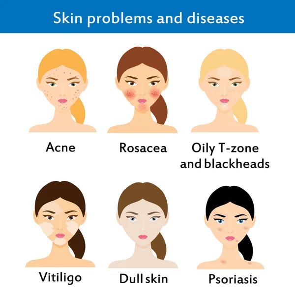 Skin problems and diseases — Stock Vector