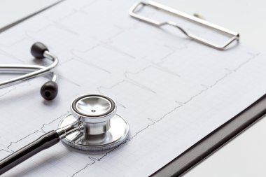 izole kardiyogram ile beyaz bir arka plan üzerinde yeni stetoskop