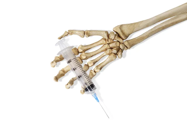 Injekciós tűvel kéz csontváz — Stock Fotó