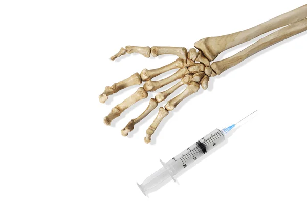 Skeleton Hand with Hypodermic Needle