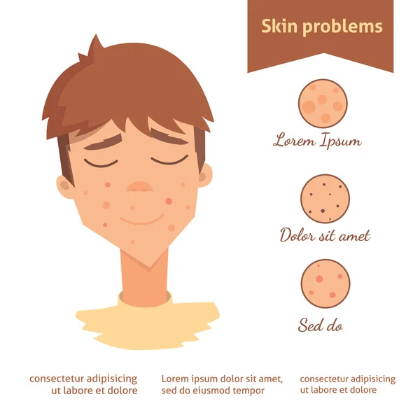 Problema de la piel vector ilustración aislada. Cuidado facial, defectos de la piel . — Archivo Imágenes Vectoriales