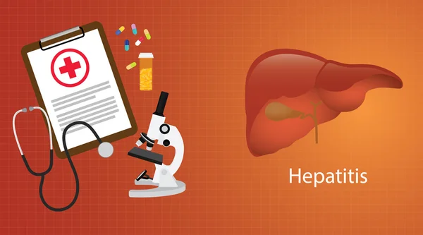 Hepatitis a b c in der Leber mit medizinischem Bericht Medizin — Stockvektor