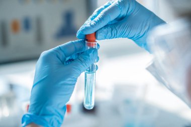Eldivenli ellerin parlak bir laboratuvar ortamında temiz çözeltisi olan bir test tüpünü tutması. Tıbbi gelişmeler için laboratuvar testleri, teşhisler ve biyoteknoloji araştırmaları