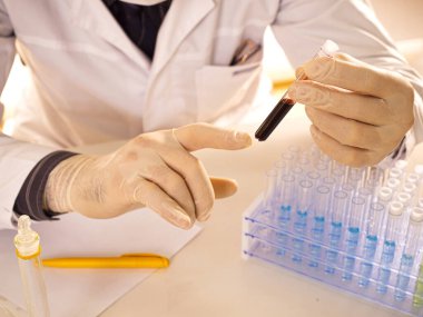 Araştırmacıların elleri kapalı. Doktor, enfekte olmuş kan örneğiyle test tüpünü inceliyor.