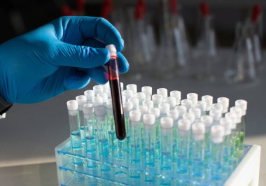 Bağışıklık araştırmaları için reaktörlerle test tüplerinin arka planına karşı bir araştırmacının ellerinde kan olan bir test tüpü..