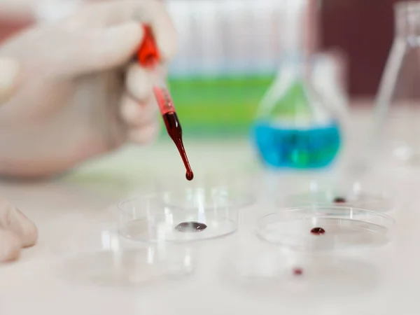 Researchers hands in a laboratory dripping a blood sample into a Petri dish. Focus on the dropper. — Stock Photo, Image