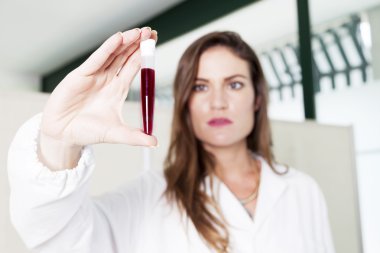 kadın doktor kan tüpü laboratuvar inceliyor