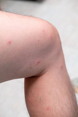 Yağmur mevsiminde denizde oynadıktan sonra benekli deri izlerinin yakın çekimi, doğal açık hava etkileri