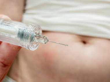 Kemoterapi tedavisini tamamlamak için kendine enjekte edilmiş bir kadın. Pompa sonuna ulaştı ve iğnede de görüldüğü gibi zaten vücuttan çıkarılmış.