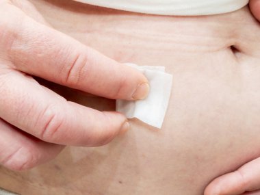 İğneden önce karın bölgesini çubukla temizliyorum.