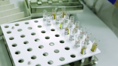 Paramedik lastik eldiven örnekleri ile tüp içinde belgili tanımlık tepsi koyar. Steril. Portre