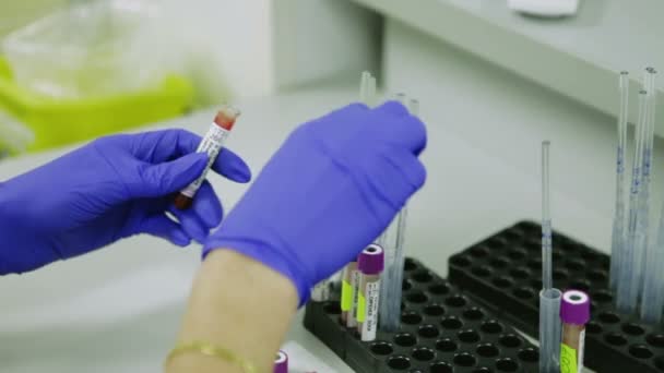 臨床検査室で血液を試験管のゴム手袋で働く科学者。クローズ アップ — ストック動画