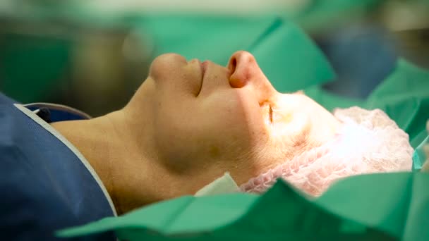 Oftalmología. Paciente femenina de mediana edad está preparada para cirugía ocular. Doctor limpia el sudor de su frente con un hisopo de algodón. De cerca. — Vídeo de stock