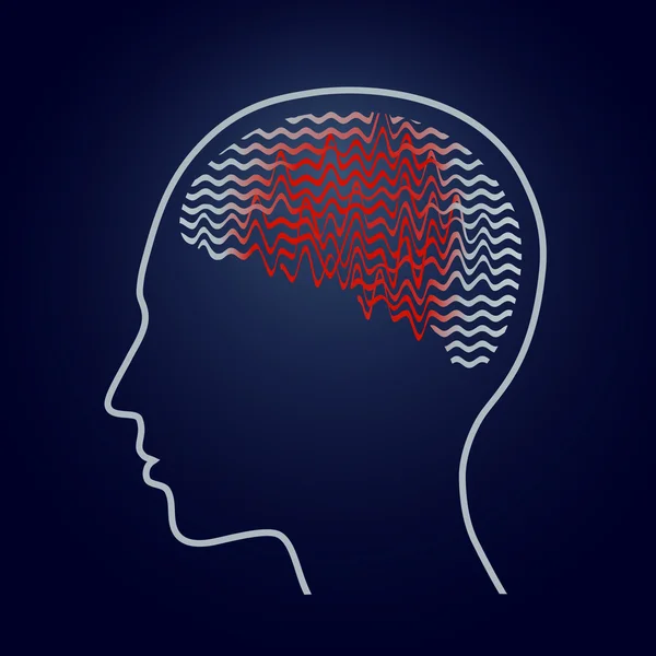 Menschliches Gehirn mit Epilepsie-Aktivität, Vektorillustration — Stockvektor