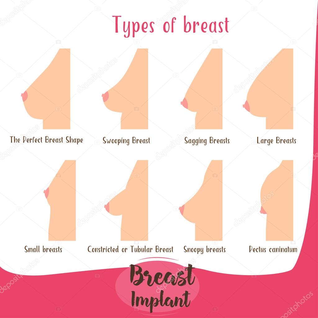Pictures of womens breast