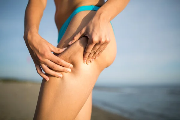 Vrouw is het testen van de huid voor striae en cellulitis op het strand. Vrouw weergegeven: cellulitis gebied. Zelf bewustzijn, zelfvertrouwen en lichaam onzekerheid. — Stockfoto