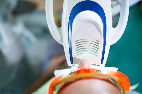 Zahnaufhellung.Mann mit Zahnaufhellung durch UV-Laser-Bleaching-Gerät. Zahnaufhellungsmaschine, mit Brille geschützte Augen — Stockfoto