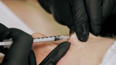 Botoks enjeksiyonu. Güzellik iğnesi. Yaşlanma önleyici iğneler. Botulinum terapisi. Yüz tazeleme. Doktor güzellik iğneleri yapıyor. Kolajen enjeksiyonları. Güzellik konsepti.
