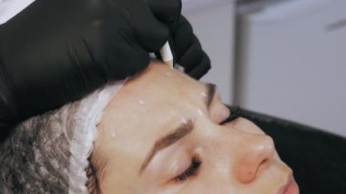 Botoks enjeksiyonu. Güzellik iğnesi. Yaşlanma önleyici iğneler. Botulinum terapisi. Yüz tazeleme. Doktor, hastaların alnında botoks için işaretler yapıyor. Kolajen enjeksiyonları. Güzellik konsepti.