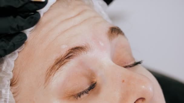 Injecção de botox. injecção de beleza. injeções antienvelhecimento. terapia botulínica. Rejuvenescimento facial. O médico faz marcações na testa dos pacientes para injeções de Botox. injecções de colagénio. Conceito de beleza. — Vídeo de Stock