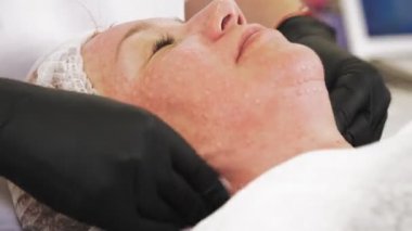 Güzellik iğnesi. Yaşlanma önleyici iğneler. Yüz tazeleme. Doktor, güzellik enjeksiyonlarından sonra hastaları antiseptik pamukla siliyor. Enjekte edilen kan izleri, deride görünen papüller.