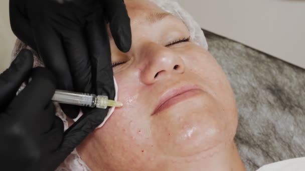 Injecção de beleza. injeções antienvelhecimento. Rejuvenescimento facial. O médico está a fazer injeções de beleza. Close-up. mesoterapia e biorevitalização. injecções de colagénio. Conceito de beleza. — Vídeo de Stock