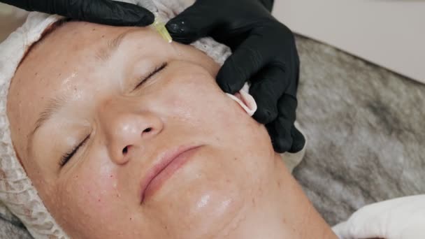 Beauty injection. anti-aging injections. Facial rejuvenation. Doctor is making beauty injections. Close-up. mesotherapy and biorevitalization. collagen injections. Beauty concept. — Stock Video