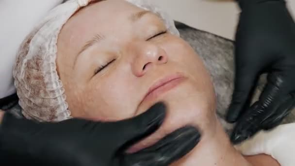 Beauty therapy. sun protection. close-up, cosmetician in black medical gloves, applies sunscreen or cosmetic cream to female face with massage movements after mesotherapy or biorevitalization — Stock Video