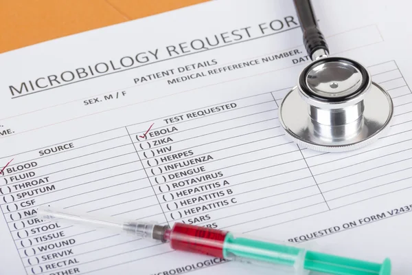 Mikrobiyolojik kan testi sonuçları Ebola virüsü için pozitif olduğunu gösteriyor