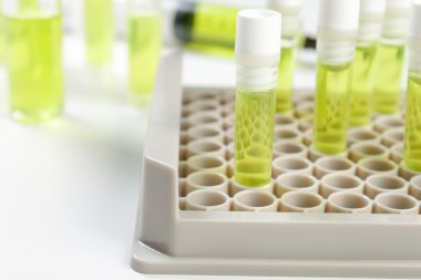 Şişeleri bir laboratuvar tezgah üzerinde yeşil sıvı