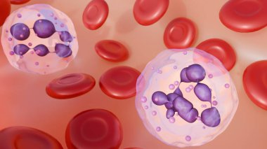 3 boyutlu sağlıklı eritrosit ve hipersegmentli nötrofiller. Bu klasik bir tanı bulgusudur, genellikle Megaloblastik Anemia ile bağlantılıdır..